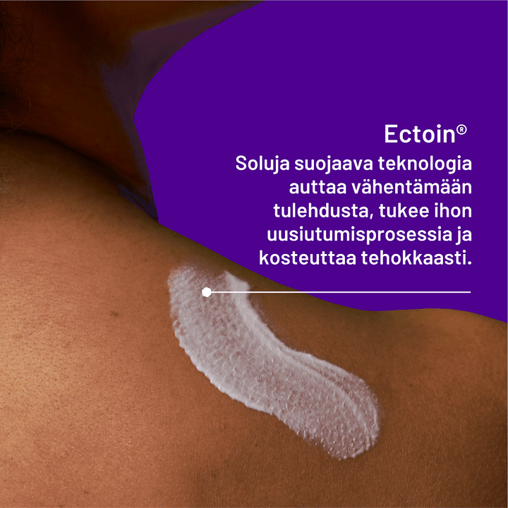 Locobase Psoriasis Cream kosteuttaa ja rauhoittaa psoriasiksen ärtynyttä ihoa